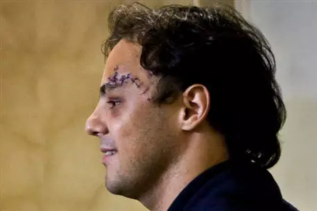 Фелипе Масса не вернется в спорт до конца года 