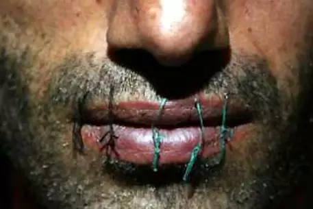 В Карагандинской области заключенные зашили себе рты в знак протеста