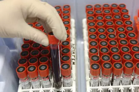 Пятерых бразильских легкоатлетов уличили в применении допинга 