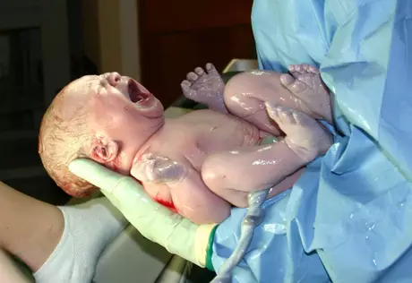 50-летняя карагандинка родила на  шестом месяце беременности