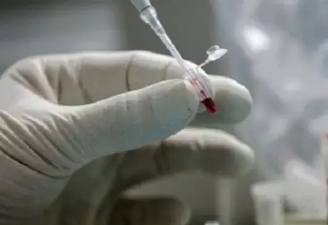 Число больных холерой венесуэльцев достигло 239