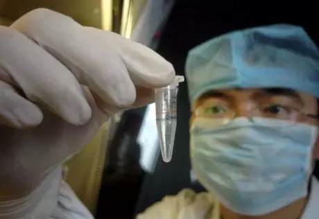 В Казахстане заболеваемость гепатитом "А" снизилась на 13 процентов