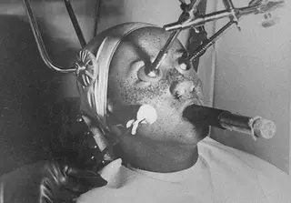 14 пугающих аппаратов из кабинета косметолога прошлого века