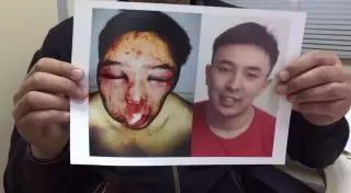 Адвокат Алиби Жумагулова рассказала о полученных им при избиении травмах