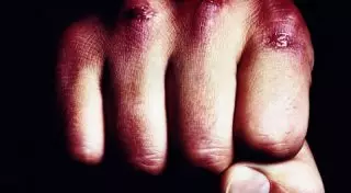 Полицейского обвиняют в жестоком избиении 18-летнего парня в Карагандинской области