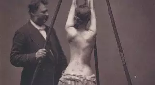 18 пугающих и завораживающих фотографий медицины прошлого