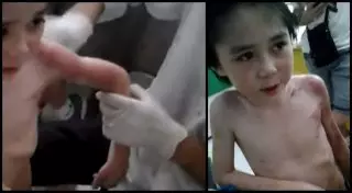 По делу об избитом матерью мальчике в Таразе назначены дополнительные экспертизы