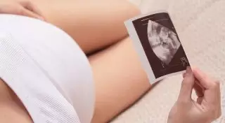 467 несовершеннолетних беременных стоят на учете в  Южном Казахстане