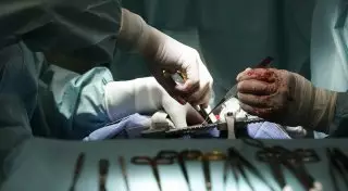 Разрыв аорты у китайского хирурга не помешал ему завершить операцию