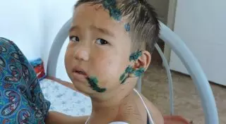 Собака содрала скальп с 3-летнего мальчика в Мангистауской области