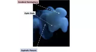 Американские ученые заявили о выращенной копии человеческого мозга