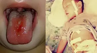 После отравления ребенка чистящим средством наказаны трое сотрудниц детсада в Туркестане