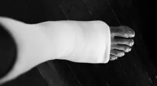 В Караганде женщина со сломанной ногой более 40 минут пролежала на снегу