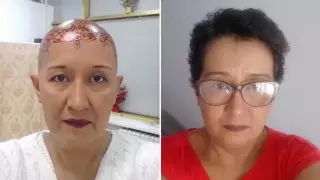 "Почему я?" Откровения казахстанки, победившей рак на последней стадии