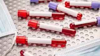 Выросло число зараженных коронавирусом в Узбекистане