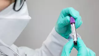 Что известно о первом случае коронавируса в Костанайской области