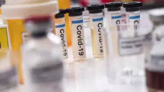 Подробности о новых случаях заражения коронавирусом рассказали в Жамбылской области