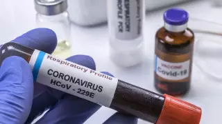 У заболевшего коронавирусом в Алматы диагностировали пневмонию