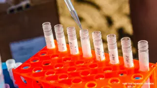 Қазақстанда коронавирусты анықтайтын жаңа тестілеу енгізілуі мүмкін