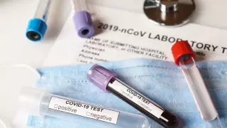 Тесты на COVID-19 в Казахстане: платно или бесплатно?