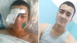 Солдата, потерявшего руку из-за взрыва на учениях в Мангистау, признали виновным