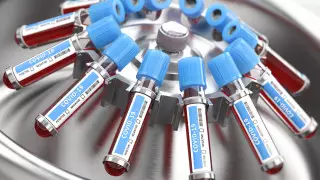 Результаты почти 5 тысяч экспресс-тестов на коронавирус озвучили в Нур-Султане