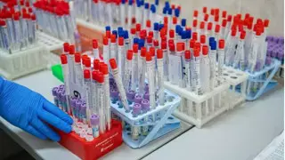 Об опасных последствиях заражения COVID-19 предупредили ученые