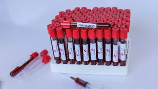 18 новых зараженных коронавирусом: 11 из них в Шымкенте