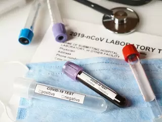 В туберкулезном центре Алматы сотрудник заболел коронавирусом