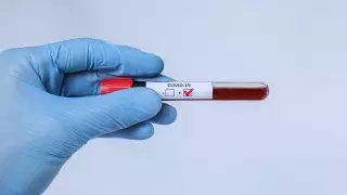 Коронавирус. Сводка на 23 апреля