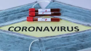 16 новых случаев COVID-19 зарегистрировали в Казахстане