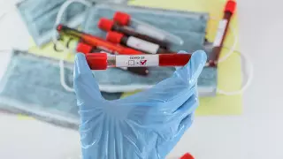 Об умершей от COVID-19 алматинке рассказали врачи