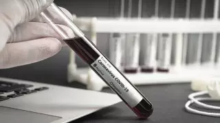 Еще один человек умер от коронавируса в Алматы