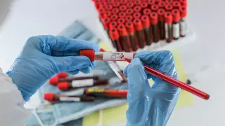 Биртанов ответил на критику о высокой цене тестов на COVID-19