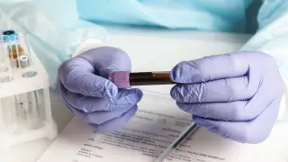 Сразу 72 новых случая коронавируса зарегистрировали в Казахстане