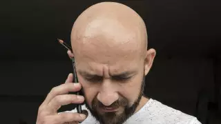 В Южной Корее нашли способ лечения облысения