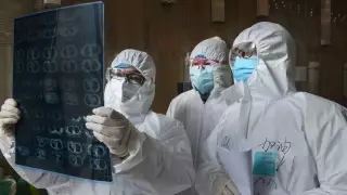 Назван возможный первый необычный симптом коронавируса