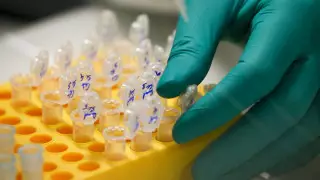 Назван способ предотвратить один из самых распространенных видов рака