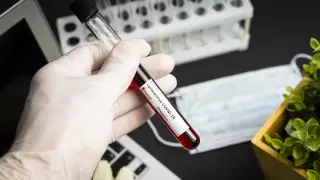 Кто может бесплатно сдать тест на коронавирус в Казахстане