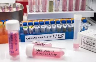 Рост заболеваемости COVID-19 в Акмолинской области увеличился в 6 раз