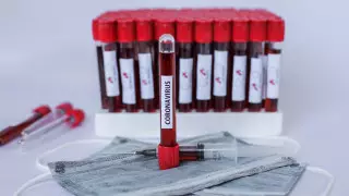 Тестирование на COVID-19 приостановили в центрах экспертизы Нур-Султана, Алматы и Шымкента