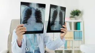 Нұр-Сұлтанда тәулігіне пневмониясы асқынған 600 адам тіркеледі - Қисықова