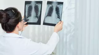 Число больных пневмонией резко выросло в Нур-Султане