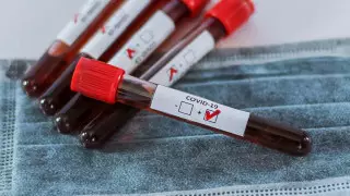 Госзакупки тестов на COVID-19 обернулись судебным иском в Павлодаре