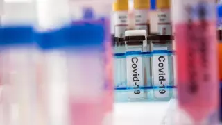 1495 случаев за сутки. Последние данные о коронавирусе в Казахстане