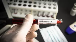 Вице-министр объяснила цену ПЦР-тестов на коронавирус