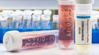 Министр ответил на вопрос о бесплатных тестах для чиновников в Казахстане