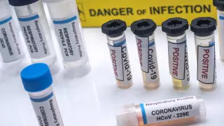 Осложнить эпидобстановку могут сезонные болезни - Минздрав