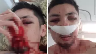 Охранников столичного бара подозревают в избиении 19-летнего парня