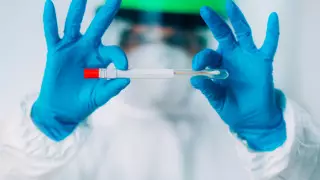 Вице-премьер поставил срок для снижения цен на ПЦР-тесты